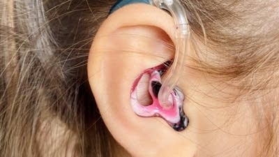 Gölcük İşitme - Çocuklar İçin İşitme Cihazları